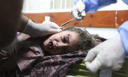 Gazze'de Doktorlar Ameliyatları Anestezisiz Yapıyor!