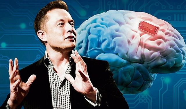 Musk: 'Beyin Çipi İkinci Hastaya da Takıldı'